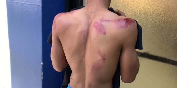 Propinan golpiza a un menor en SFM