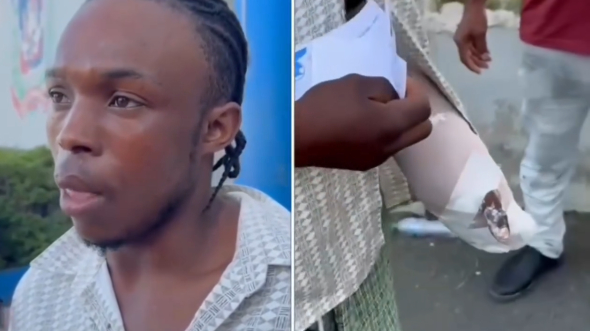 Video | Haitiana casi amputa ayuda a su pareja; él la defiende y dice “fue usada por un demonio” Video | Haitiana casi amputa ayuda a su pareja; él la defiende y dice “fue usada por un demonio”