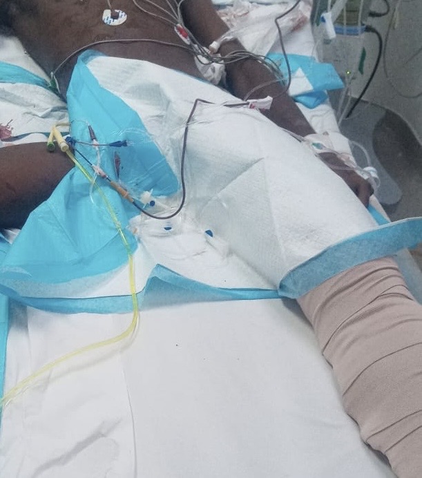 Cuatro estudiantes resultan heridos en suerte de tránsito en Don Juan, Monte Plata