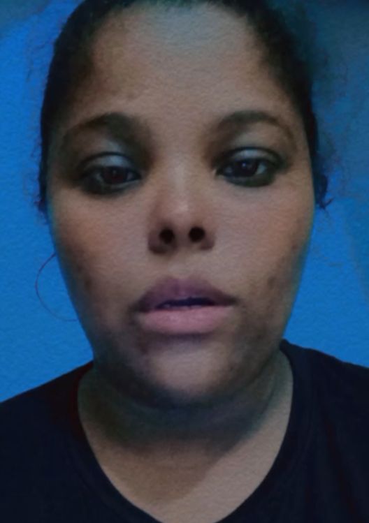 Principio desesperada pide ayuda para su hija de un año con cáncer de colon Principio desesperada pide ayuda para su hija de un año con cáncer de colon